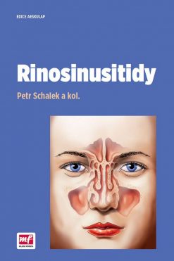 Rinosinusitidy- Petr Schalek