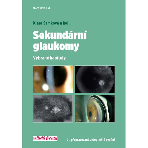 Sekundární glaukomy Sekundární glaukomy