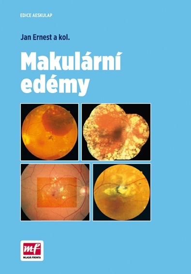 makularni-edemy Makulární edémy