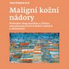 Maligní kožní nádory
